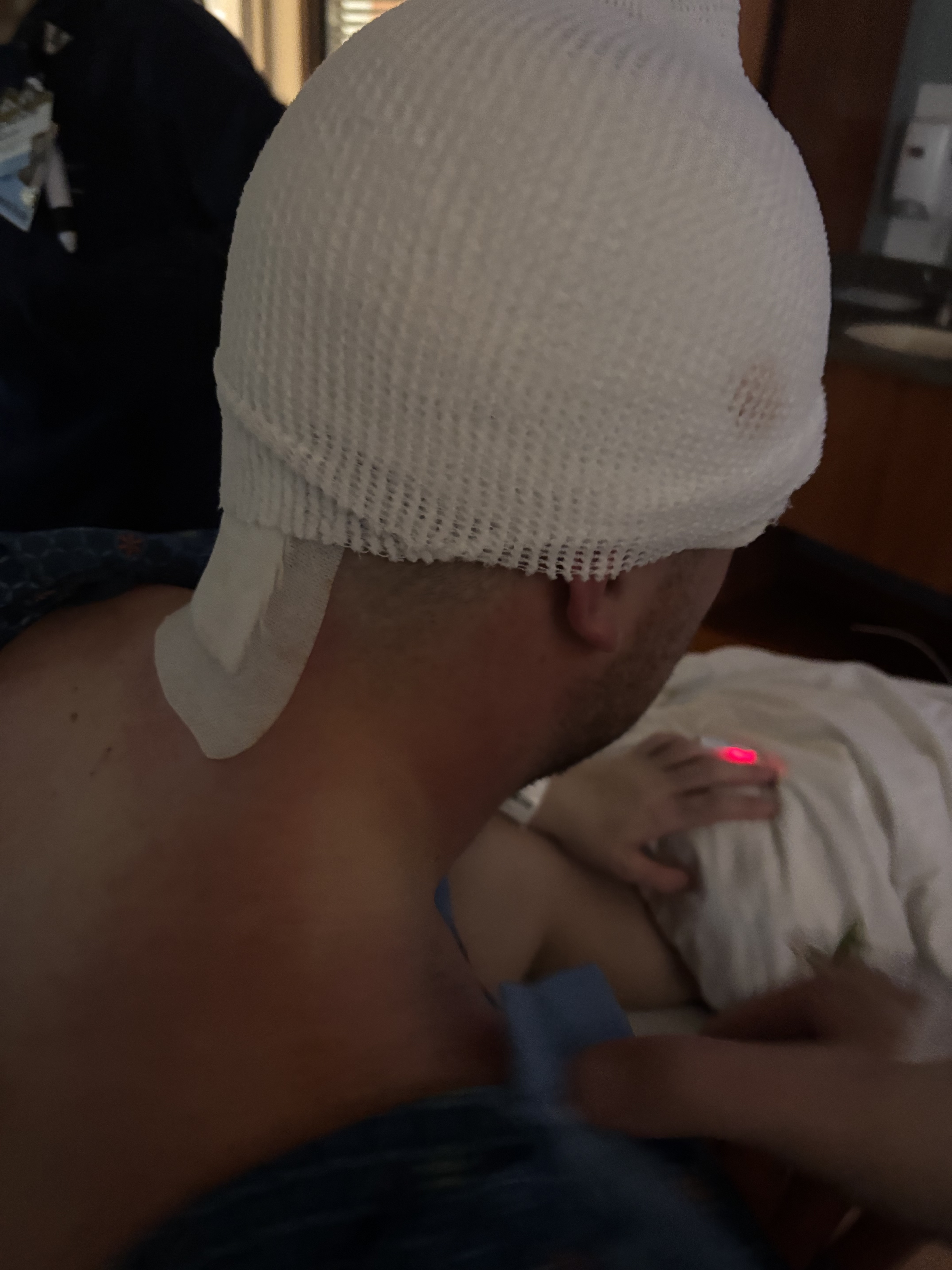 Bandaging on the back of Joe's head after surgery